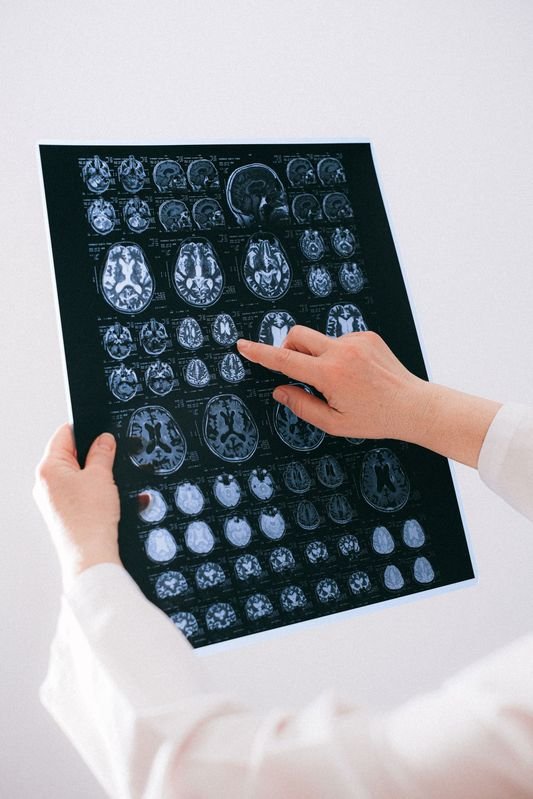 Neurosciences